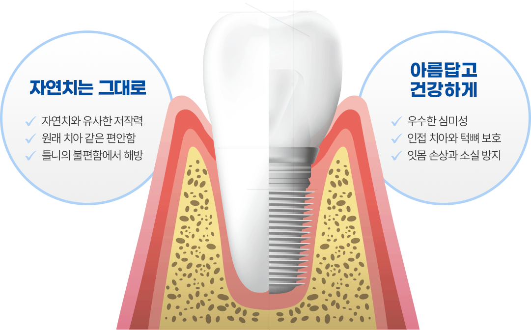 자연치는 그대로 아름답고 건강하게