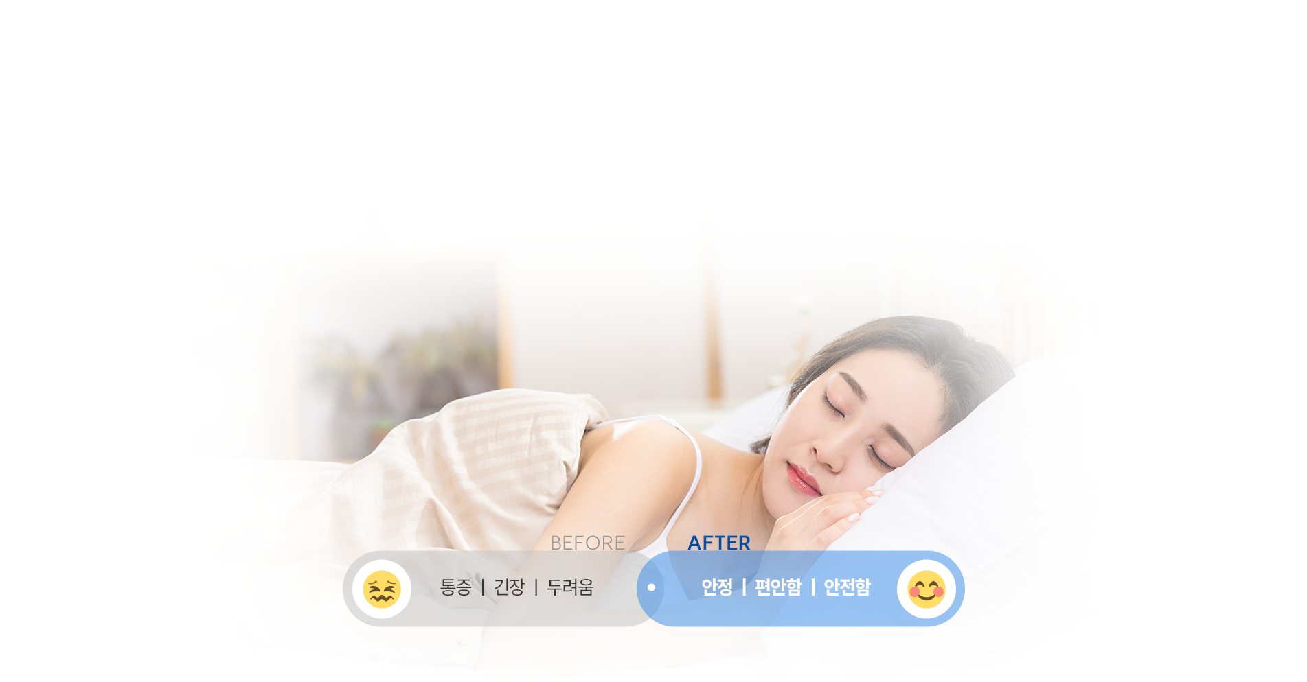 의식하 진정 임플란트