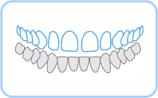 치아 사이가 벌어진 경우