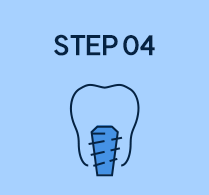 step 04
