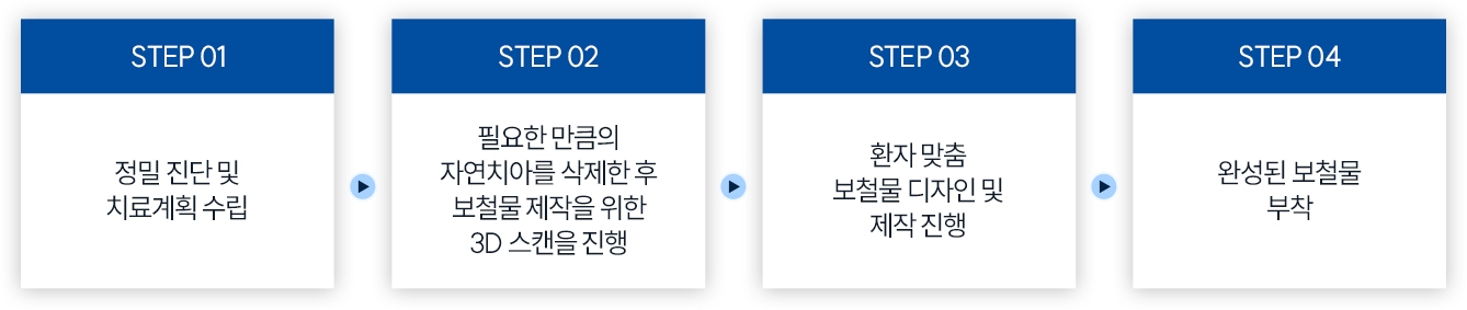 01.정밀 진단 및 치료계획 수립 02.필요한 만큼의 자연치아를 삭제한 후 보철물 제작을 위한 3D 스캔을 진행 03. 환자 맞춤 보철물 디자인 및 제작 진행 04. 완성된 보철물 부착