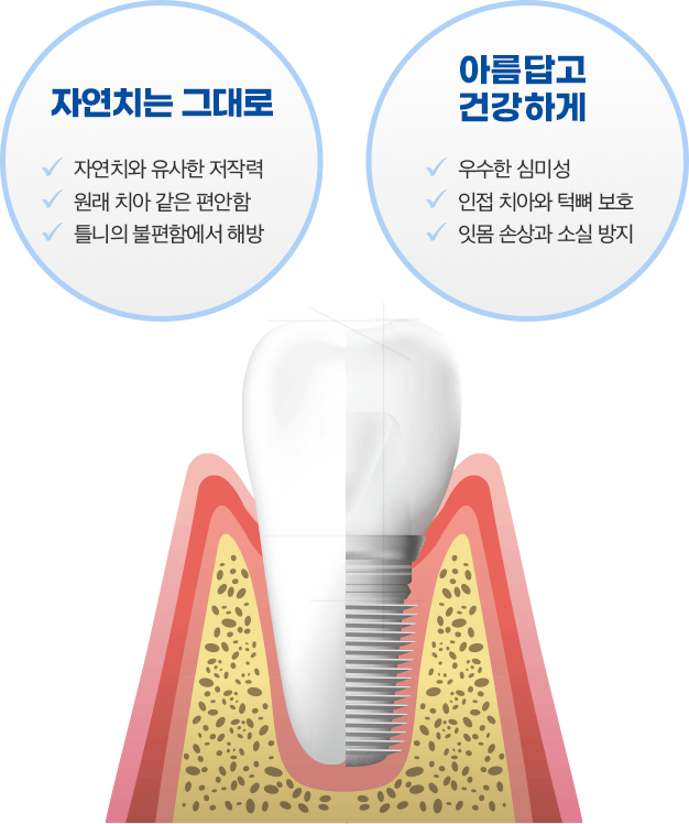 자연치는 그대로 아름답고 건강하게