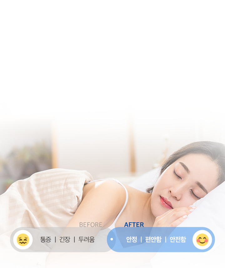 의식하 진정 임플란트