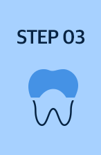 step 03