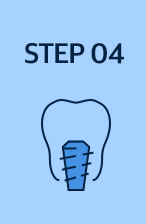 step 04