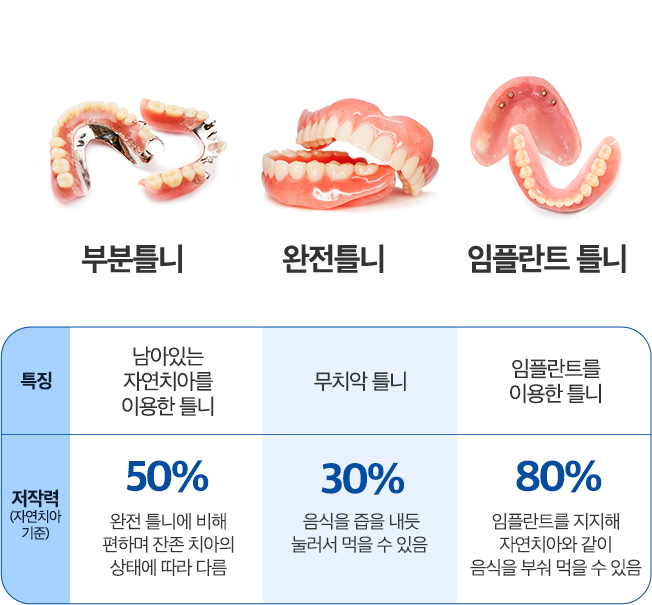 부분틀니/완전틀니/임플란트 틀니